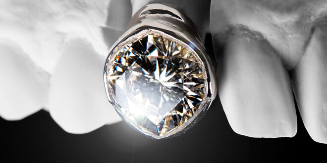 Post Malone - The Diamond Collection (Deluxe)